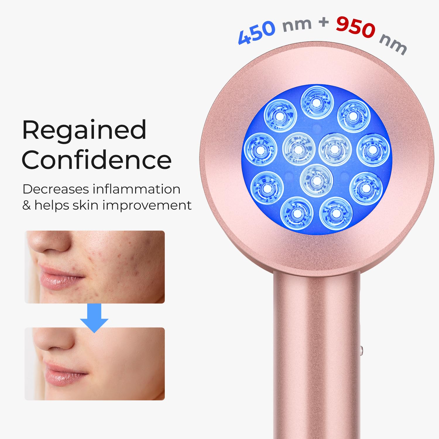 Cuidado de la piel terapia de  - Galvanic Skin Sensor reseña y precio